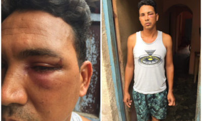 Pescador cubano sufre una golpiza por parte de guardacostas en Matanzas