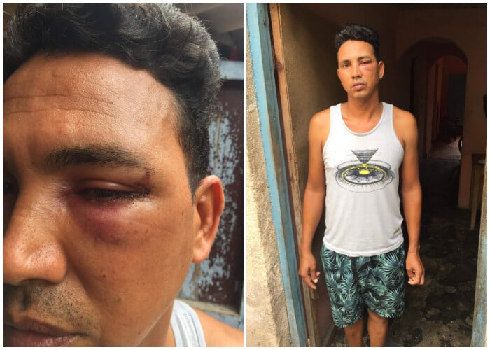 Pescador cubano sufre una golpiza por parte de guardacostas en Matanzas