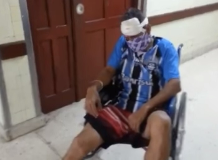 Cubano esperó horas con herida en la cabeza para ser atendido en La Habana