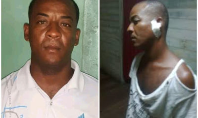 Activista de la UNPACU recibe golpiza tras ser detenido por “acaparamiento”