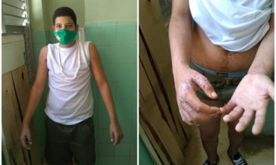 Del servicio militar al hospital, joven cubano regresa a casa con problemas de salud