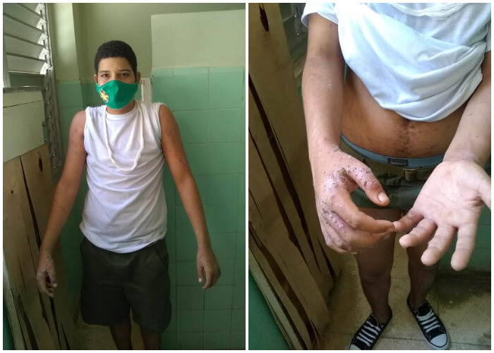 Del servicio militar al hospital, joven cubano regresa a casa con problemas de salud