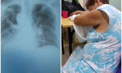 Vecina de Holguín necesita medicinas por un grave problema en sus pulmones