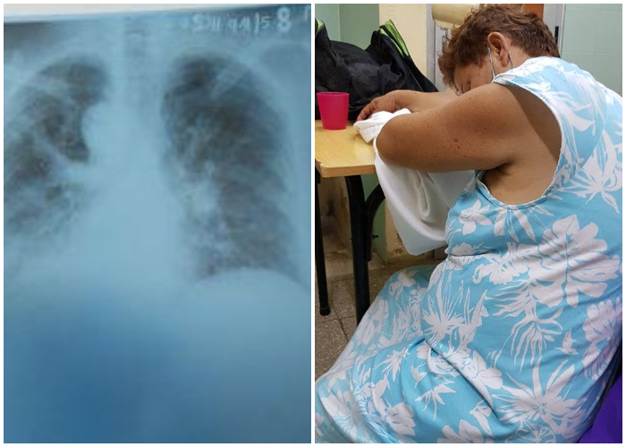 Vecina de Holguín necesita con medicinas por un grave problema en sus pulmones