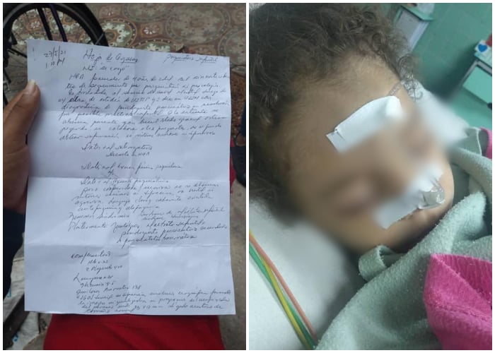 Madrasta dio golpiza a niña de cuatro años en Camagüey y continúa libre