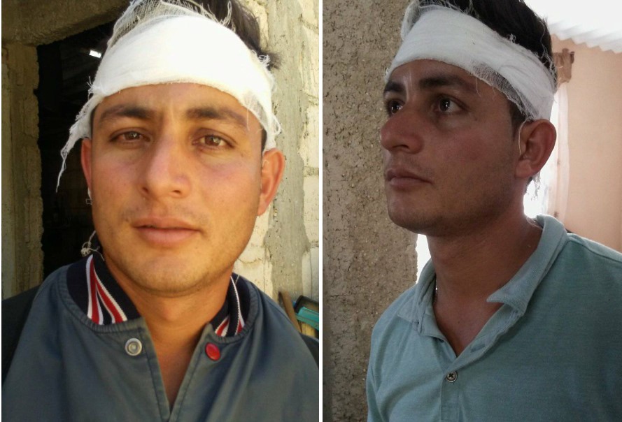Herido por los guardacostas en Playa Baracoajpg
