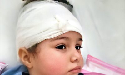 Nueva oportunidad para Ashly Rodríguez: la niña cubana con un tumor en la cabeza llegó a Florida para una operación