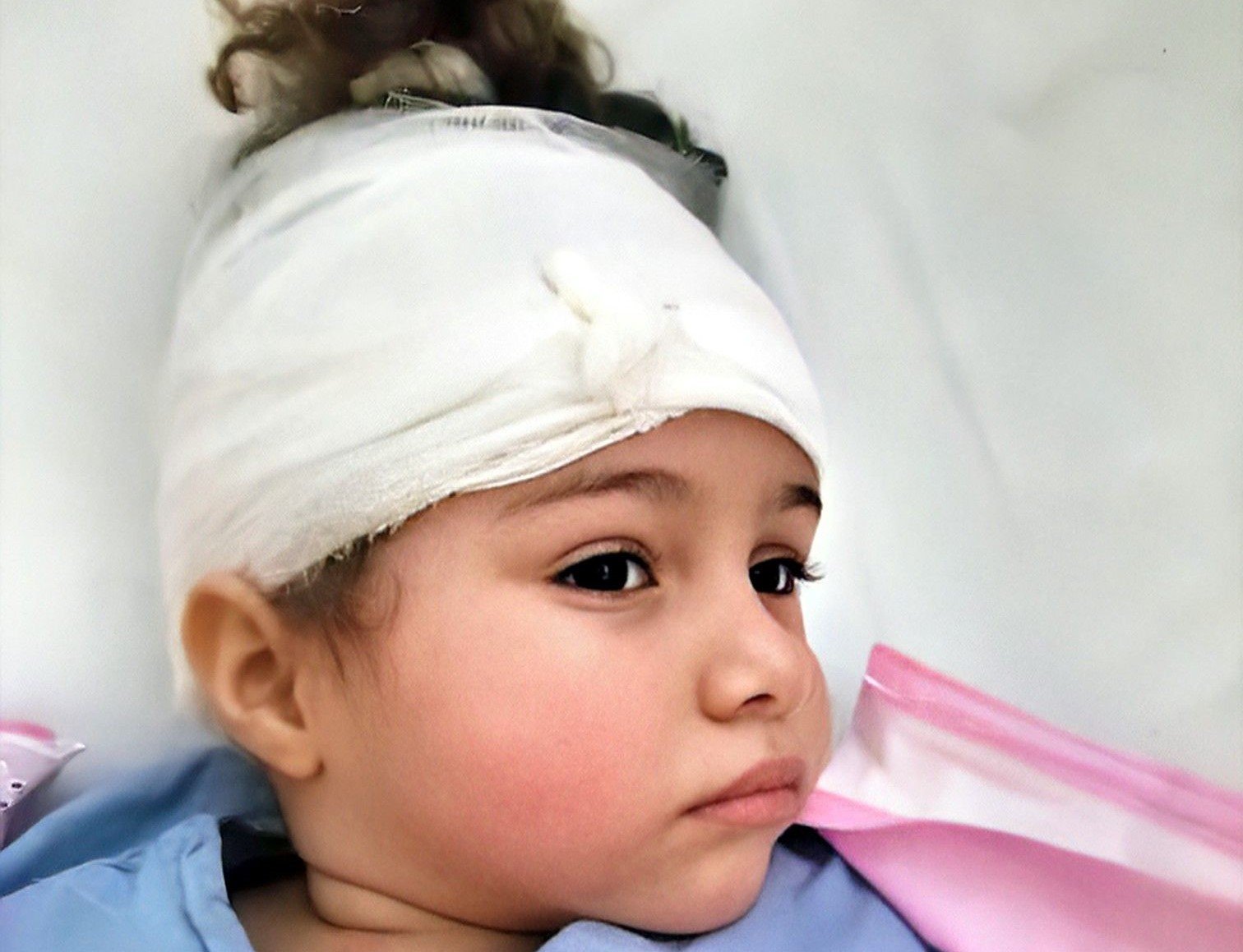 Niña cubana con tumor en la cabeza necesita ayuda para ser atendida en un hospital de Miami
