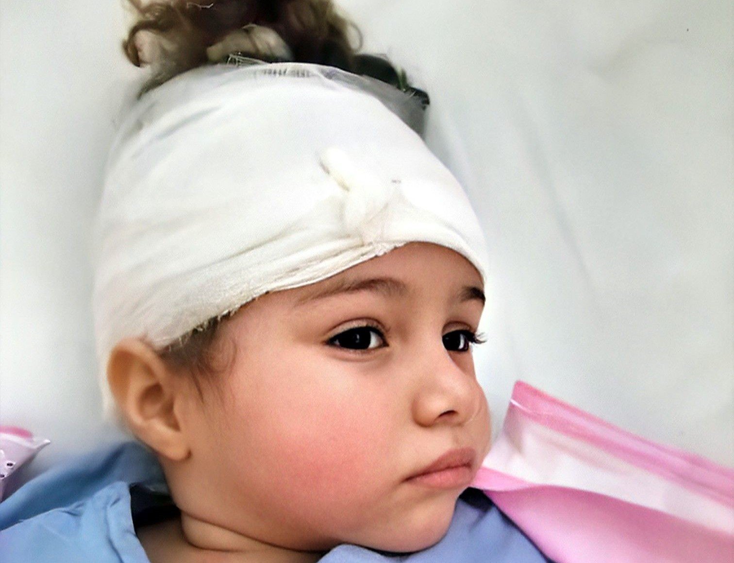 Niña cubana con tumor en la cabeza recibe ayuda del senador Marco Rubio