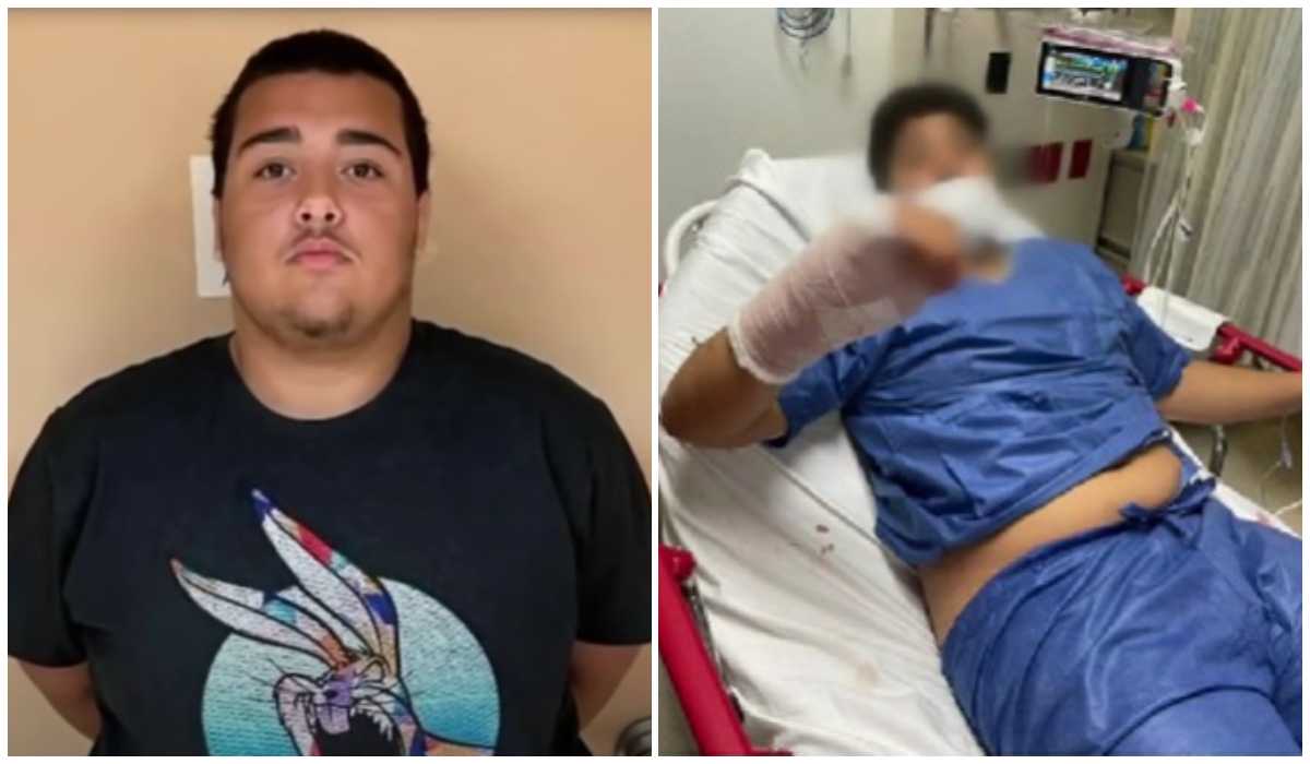 Revelan más datos acerca del apuñalamiento de un joven en un parque de Hialeah