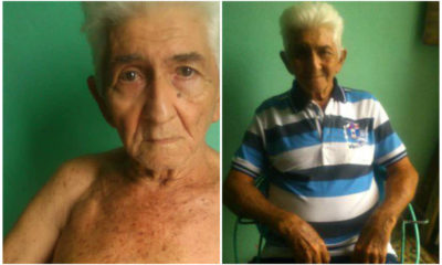 Anciano solo cuenta con un mes de vida ante la falta de marcapasos en Cuba