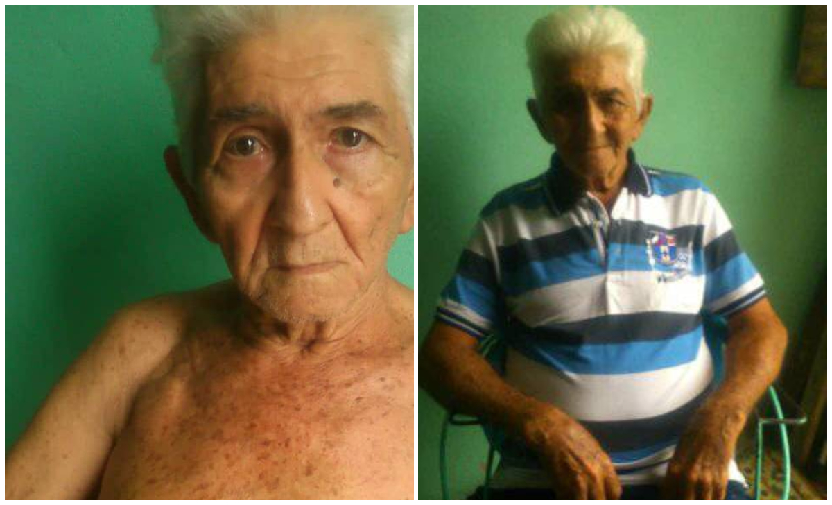 Anciano solo cuenta con un mes de vida ante la falta de marcapasos en Cuba