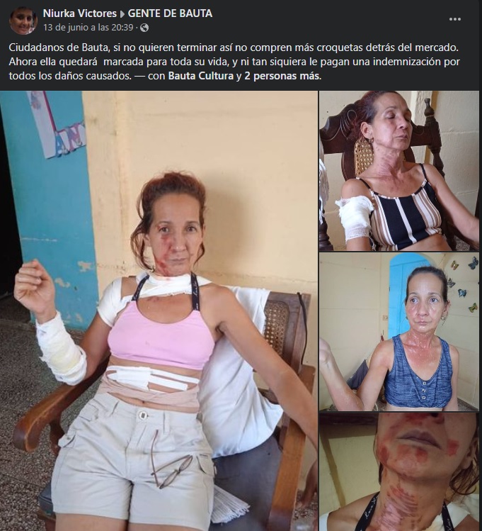 Croquetas explosivas en Bauta