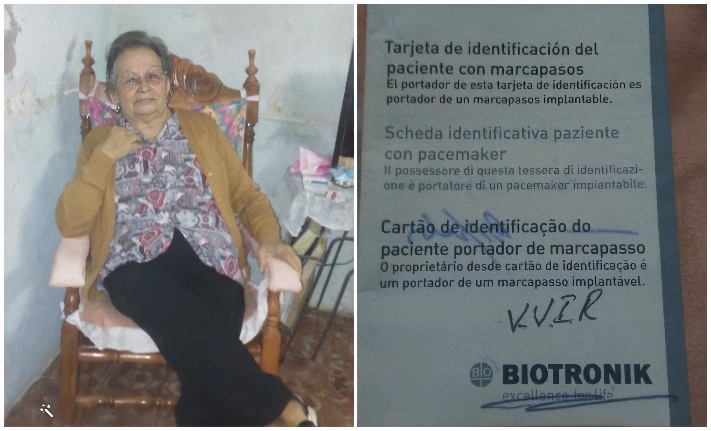 Anciana de Matanzas requiere un marcapasos que no es posible encontrarlo en la Isla