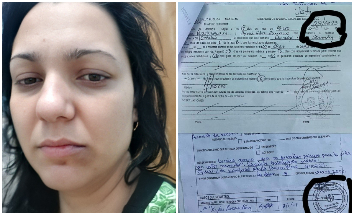 Cubana agredida por miembro del PCC denuncia pésima atención en Medicinal Legal