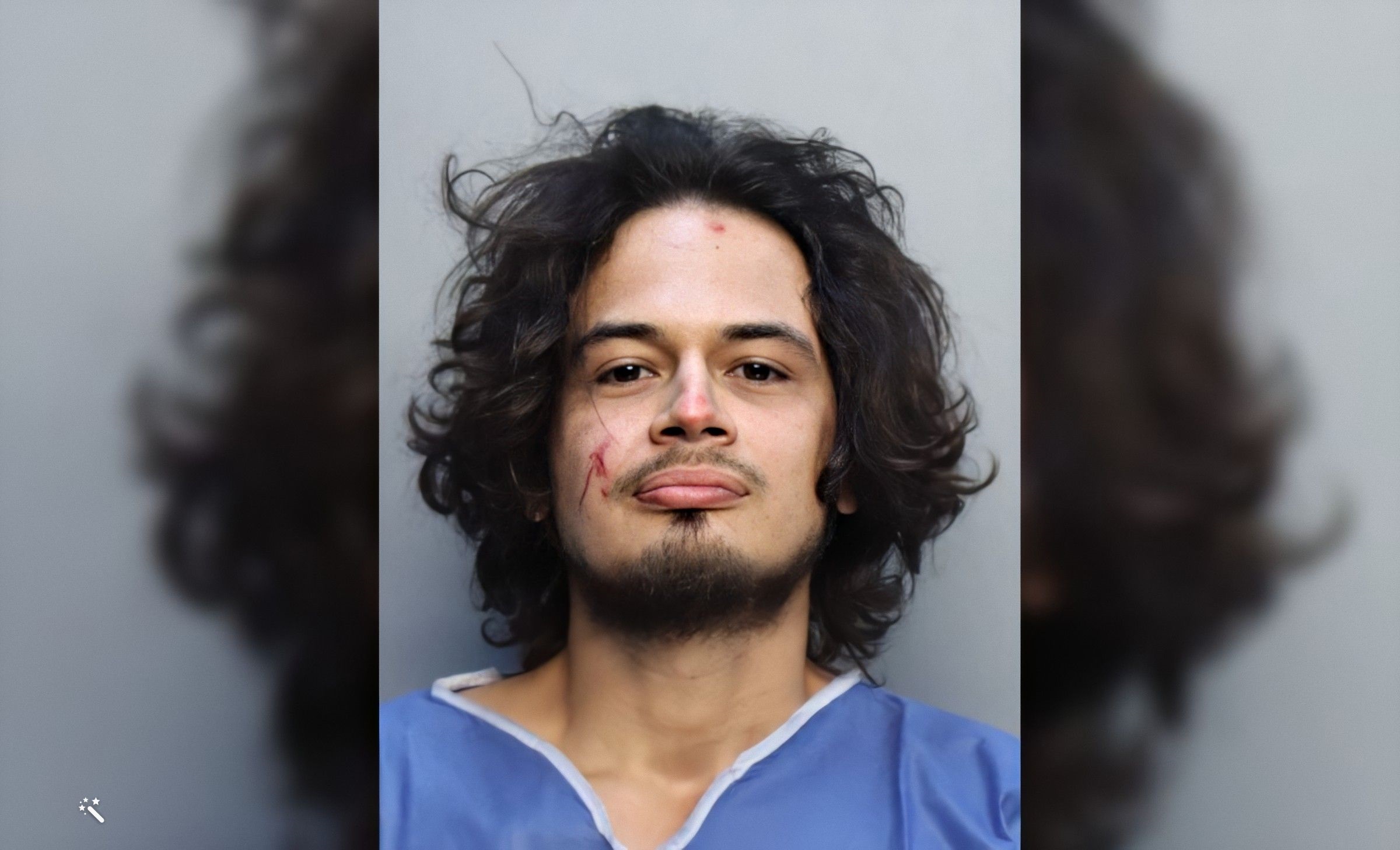 Joven sospechoso de decapitar a una serpiente con los dientes en Miami-Dade