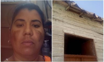 Madre cubana enferma de lupus necesita con urgencia una casa para vivir con sus tres hijos 2 (2)