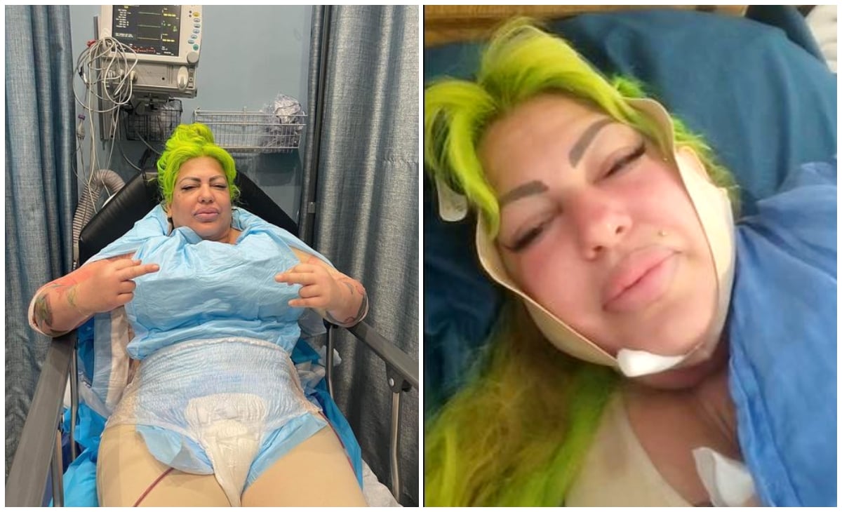 ¡La Diosa de Cuba ya tiene una nueva imagen¡ Así luce después de la operación