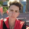 Brutal asalto en Holguín joven es agredido con machete por un ladrón que le robar su celular 2