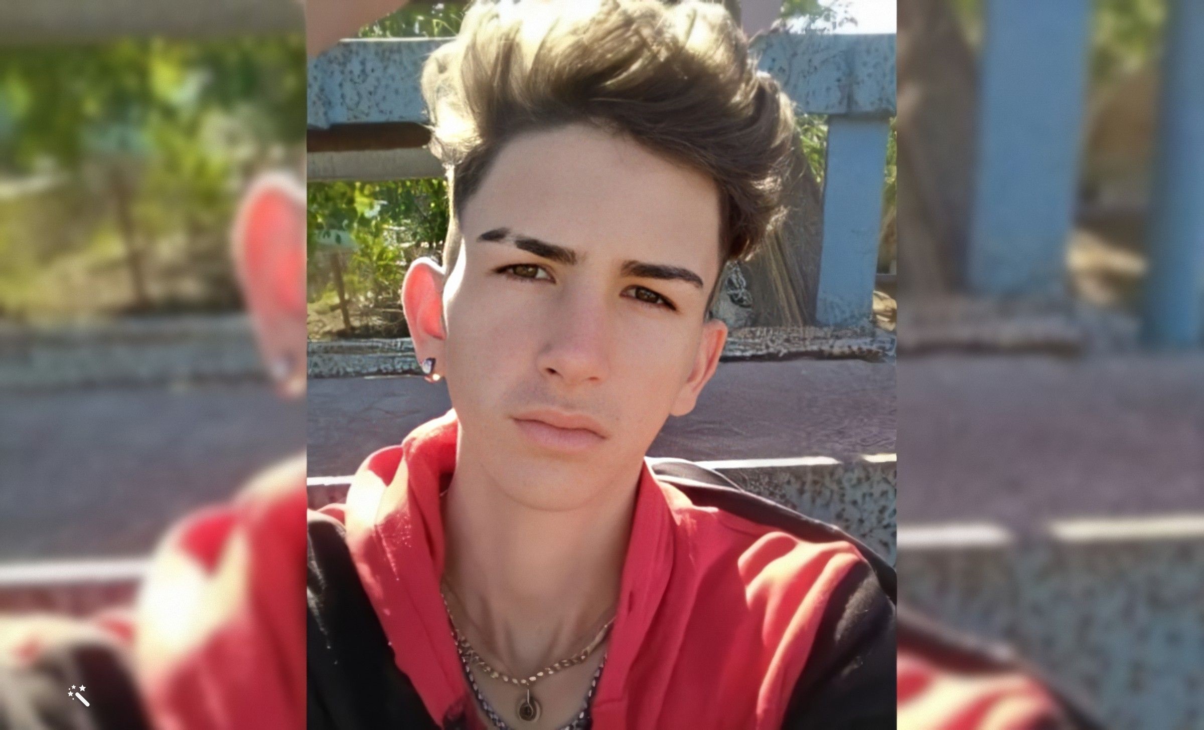 Brutal asalto en Holguín joven es agredido con machete por un ladrón que le robar su celular 2