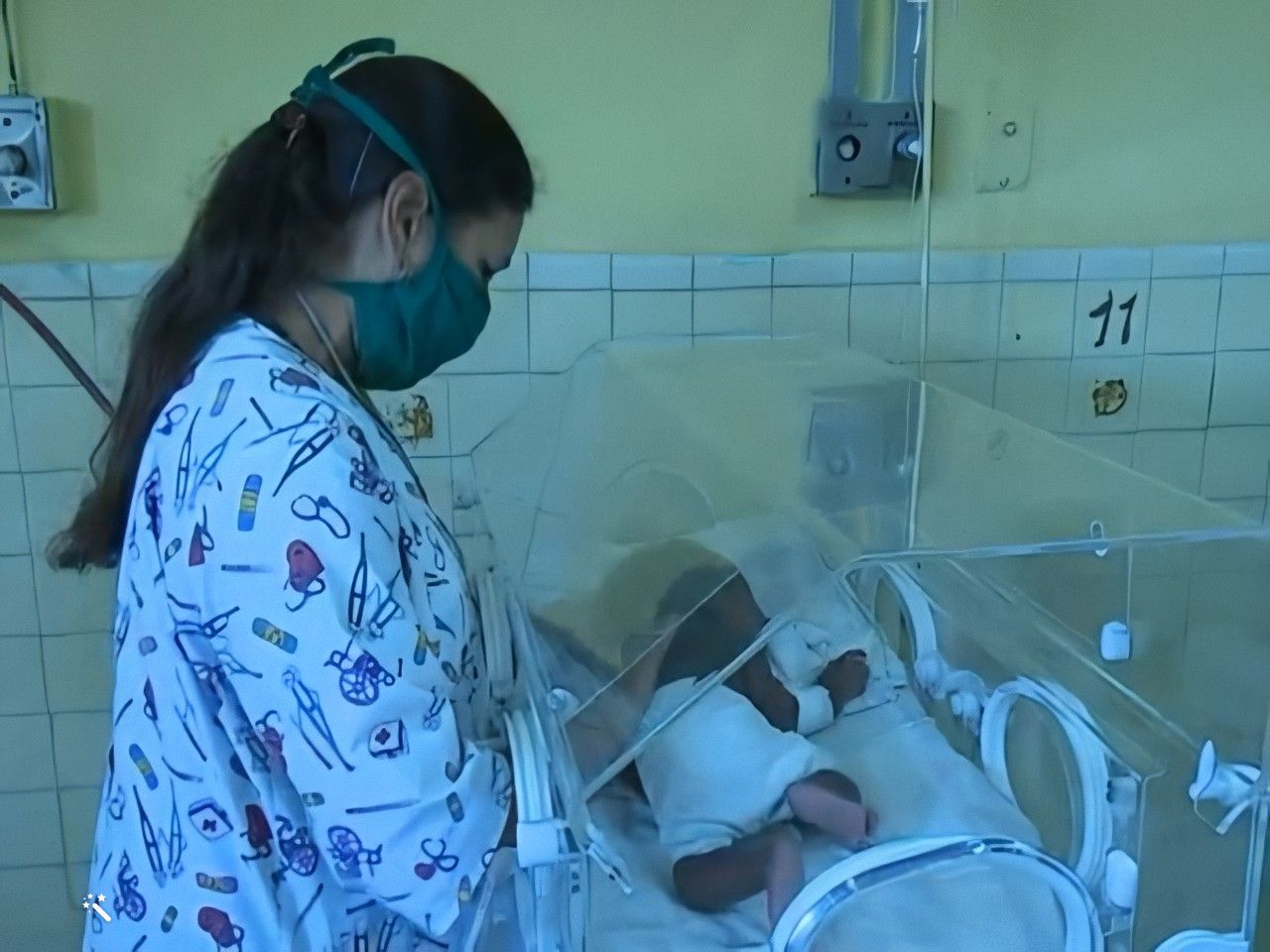 En la provincia de Guantánamo registra un aumento de enfermedades raras en recién nacidos
