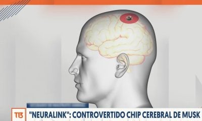 Elon Musk y su empresa Neuralink obtienen la autorización de la FDA para implantar chips cerebrales