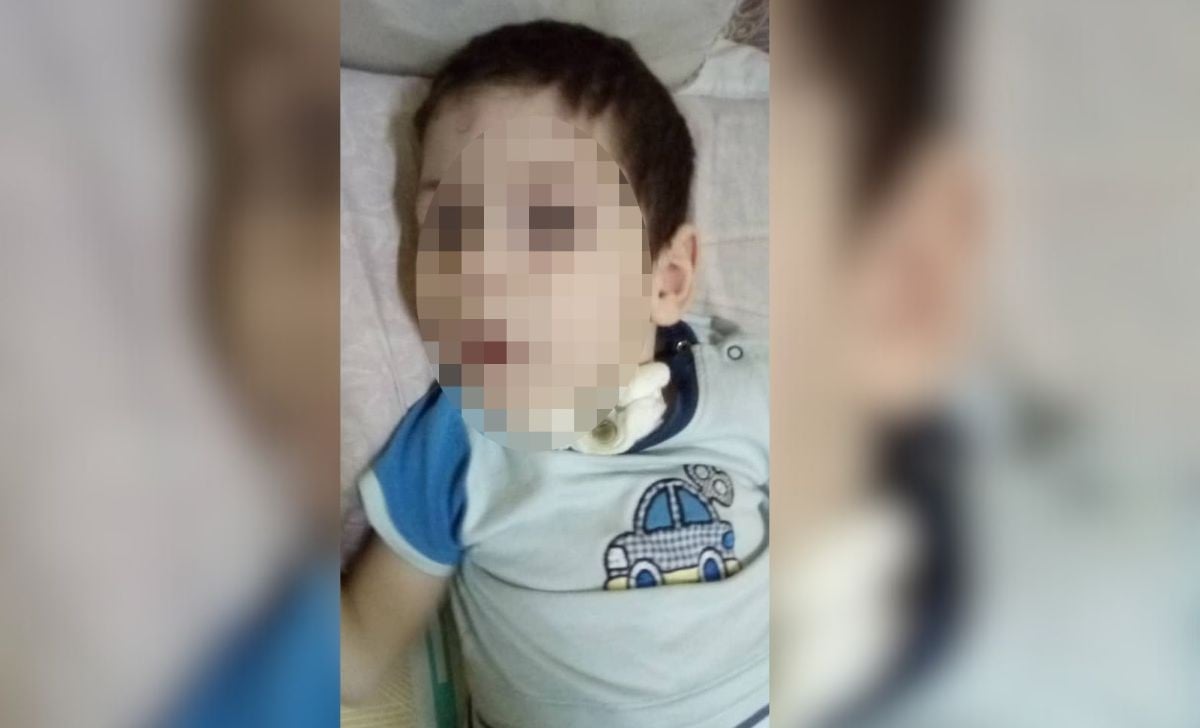 Niño cubano con parálisis cerebral necesita con urgencia una aspiradora para su traqueotomía