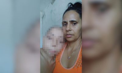 Urgente niño cubano con tumor avanzado necesita un medicamento desabastecido en la Isla