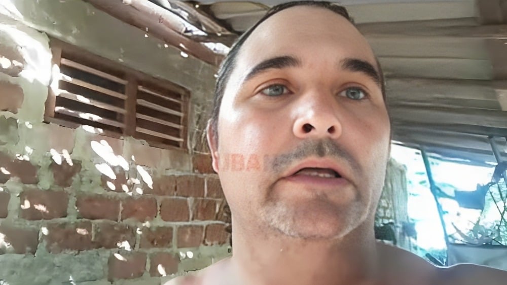 Campesino cubano se extrae una muela por falta de anestesia en clínicas dentales (1)