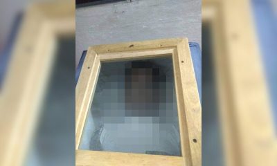 Joven con graves lesiones muere bajo custodia de la policía cubana en Camagüey