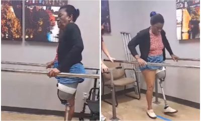 Mujer que perdió una pierna en Cuba vuelve a caminar en EEUU