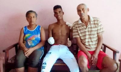 Joven cubano que perdió una mano tras asalto ya está de alta médica