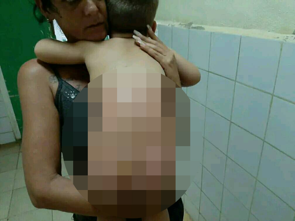 Niño de Ciego de Ávila requiere donaciones de vendas para su tratamiento por quemaduras