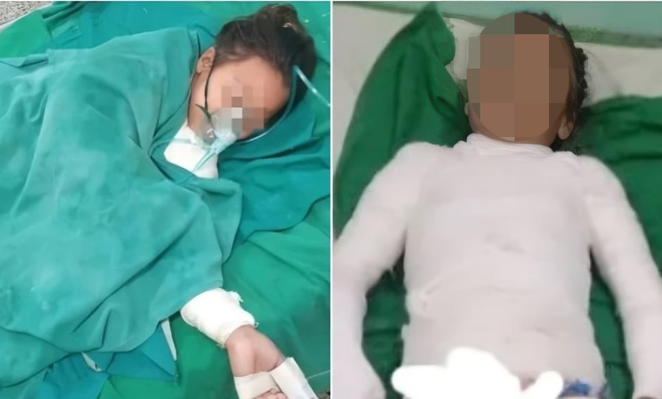 Niños de Quivicán necesitan medicinas tras sufrir graves quemaduras3