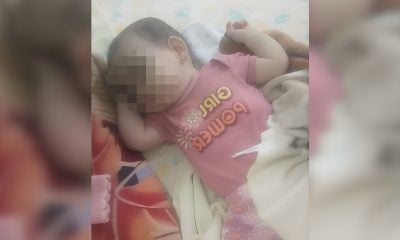 Bebé necesita donación de una válvula para una operación urgente en Matanzas (1)