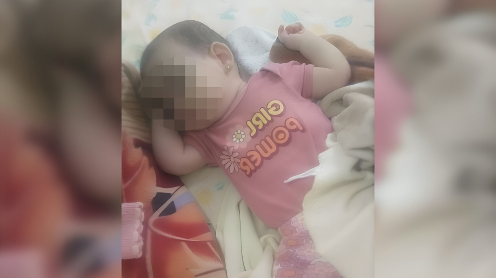 Bebé necesita donación de una válvula para una operación urgente en Matanzas (1)