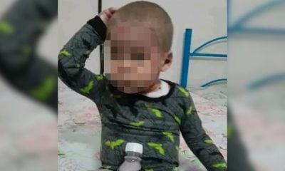 Bebé de Pinar del Río necesita ayuda ante una grave enfermedad en la piel