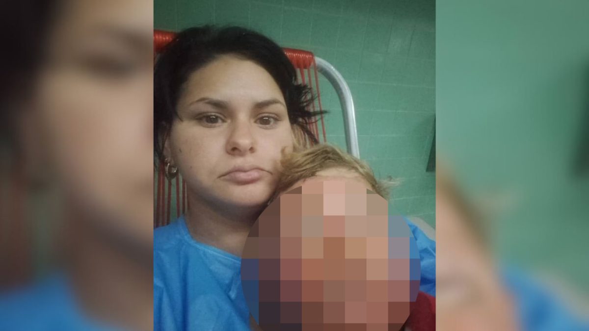 Madre de Matanzas pide medicinas para su hijo con quemaduras en el rostro1