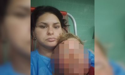 Madre de Matanzas pide medicinas para su hijo con quemaduras en el rostro1