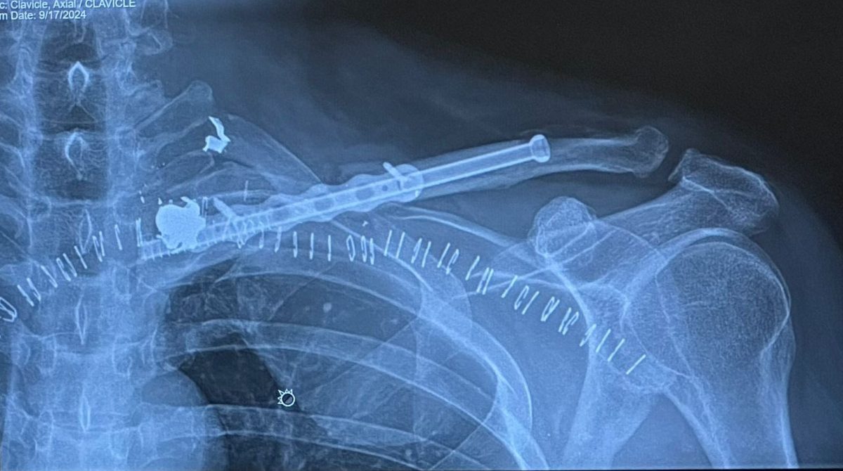 Manuel Milanés revela detalles de su cirugía