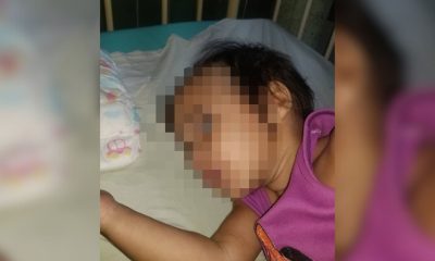 Niña de Las Tunas con hidrocefalia necesita con urgencia una válvula autorregulable