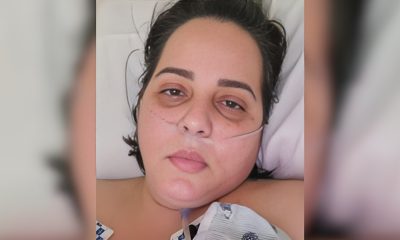 Madre cubana en Miami pide ayuda para enfrentar grave enfermedad de la piel (1)