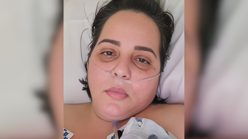 Madre cubana en Miami pide ayuda para enfrentar grave enfermedad de la piel (1)