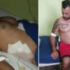 Ex lanzador Maykel Hidalgo recibe brutal golpiza tras asalto en La Habana