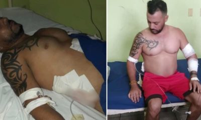 Ex lanzador Maykel Hidalgo recibe brutal golpiza tras asalto en La Habana