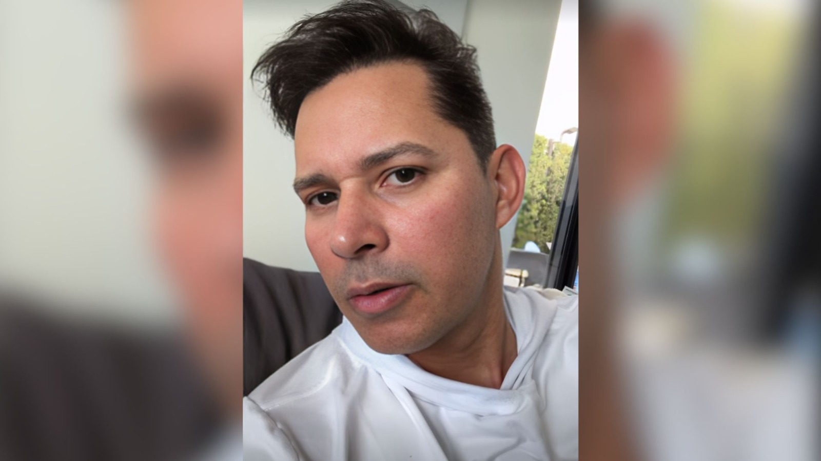 Leoni Torres se somete a tratamiento estético en Miami