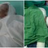 Solicitan donaciones para dos niños cubanos en estado crítico por explosión de un cilindro de gas