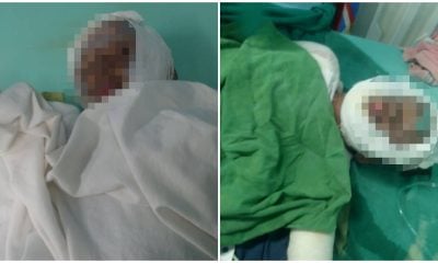 Solicitan donaciones para dos niños cubanos en estado crítico por explosión de un cilindro de gas