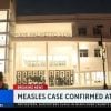 Brote de sarampión llega a Florida confirman caso positivo en un estudiante de Miami-Dade (13)