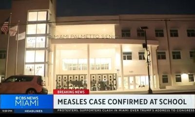 Brote de sarampión llega a Florida confirman caso positivo en un estudiante de Miami-Dade (13)